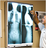 X-Ray image used by Fredrick Family Chiropractic of Delta County